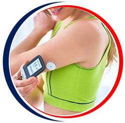 Continuous Glucose Monitoring - Arkansas Diabetes and Endocrinology Center Near Me in Little Rock, AR