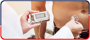 Insulin Pumps and CGM - Arkansas Diabetes and Endocrinology Center Near Me in Little Rock, AR Insulin Pumps and CGM - Arkansas Diabetes and Endocrinology Center Near Me in Little Rock, AR