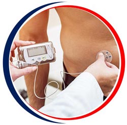Insulin Pumps CGM - Arkansas Diabetes and Endocrinology Center Near Me in Little Rock, AR
