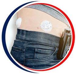 Closed Loop Insulin Pump Systems Near Me in Little Rock, AR