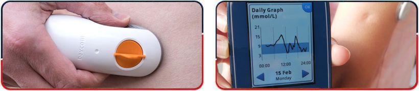 Continuous Glucose Monitoring - Arkansas Diabetes and Endocrinology Center Near Me in Little Rock, AR Continuous Glucose Monitoring - Arkansas Diabetes and Endocrinology Center Near Me in Little Rock, AR