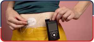 Insulin Pumps and CGM - Arkansas Diabetes and Endocrinology Center Near Me in Little Rock, AR