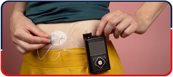 Insulin Pumps and CGM - Arkansas Diabetes and Endocrinology Center Near Me in Little Rock, AR